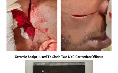 Rikers Island Inmate Attacks Guards with Blade in Gruesome Assault