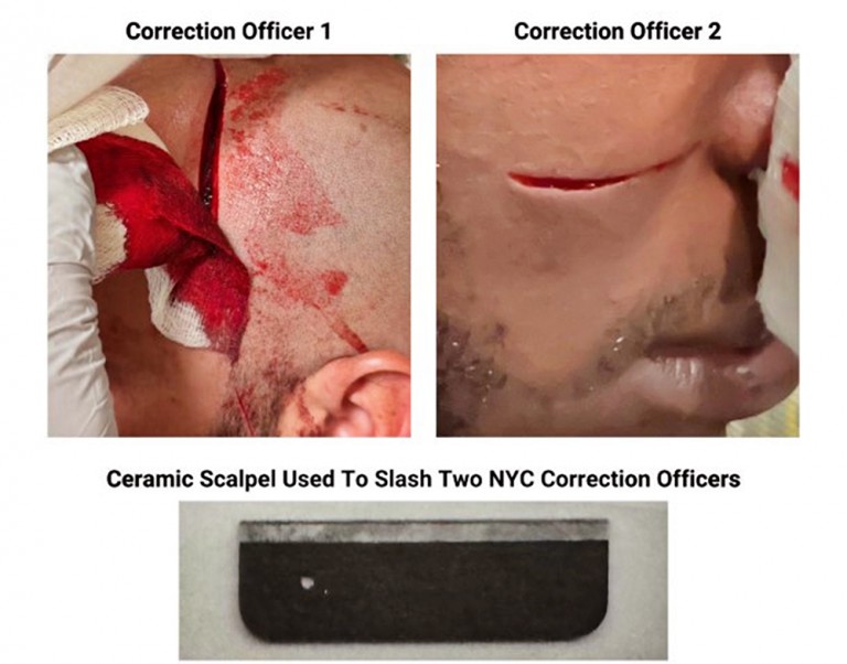 Rikers Island Inmate Attacks Guards with Blade in Gruesome Assault